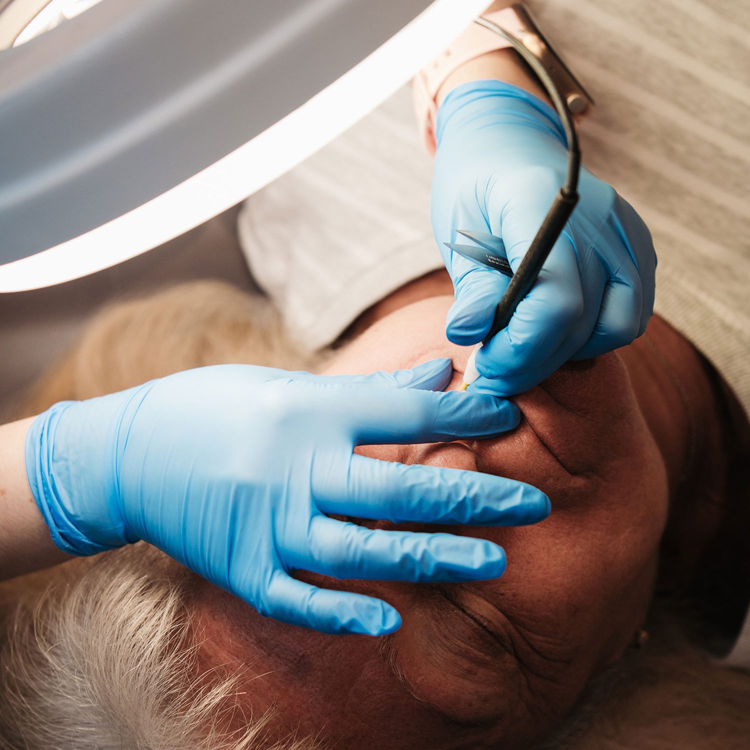 photo-epilation-electrolyse-institut-kaina
